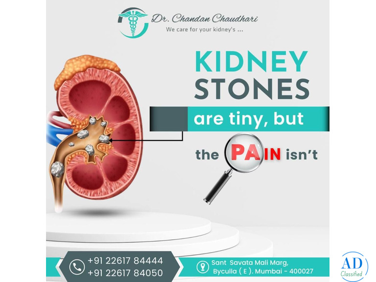 Advanced Kidney Stone Treatment in Mumbai by Dr. Chandan Chaudhari