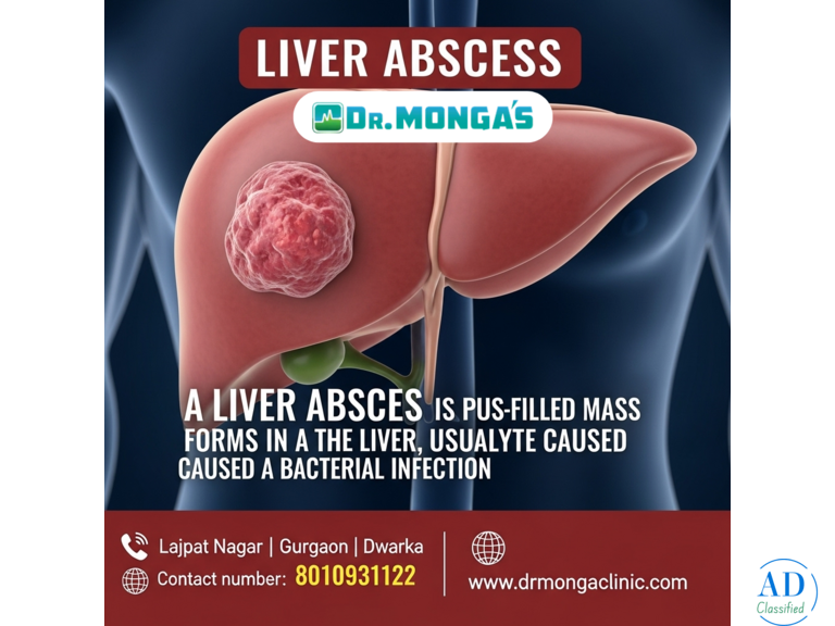 Precautions After Liver Abscess