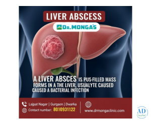 Precautions After Liver Abscess