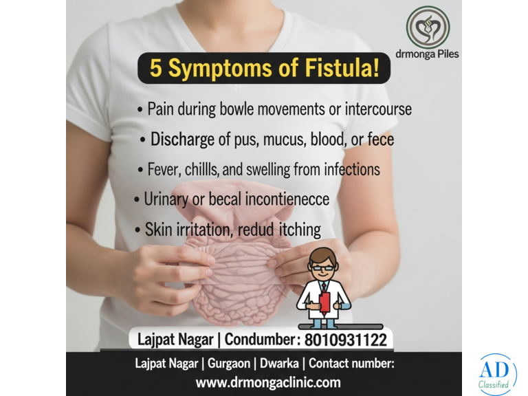 Best Treatment for Fistula