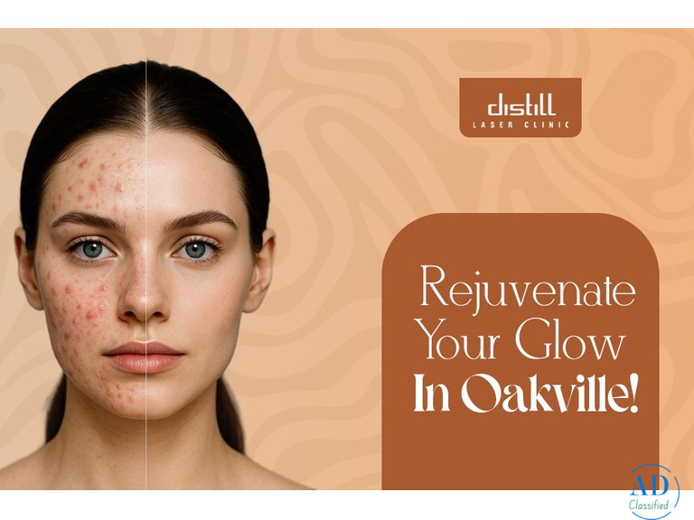 Best Morpheus8 Treatments In Oakville | Distill Laser Clinic