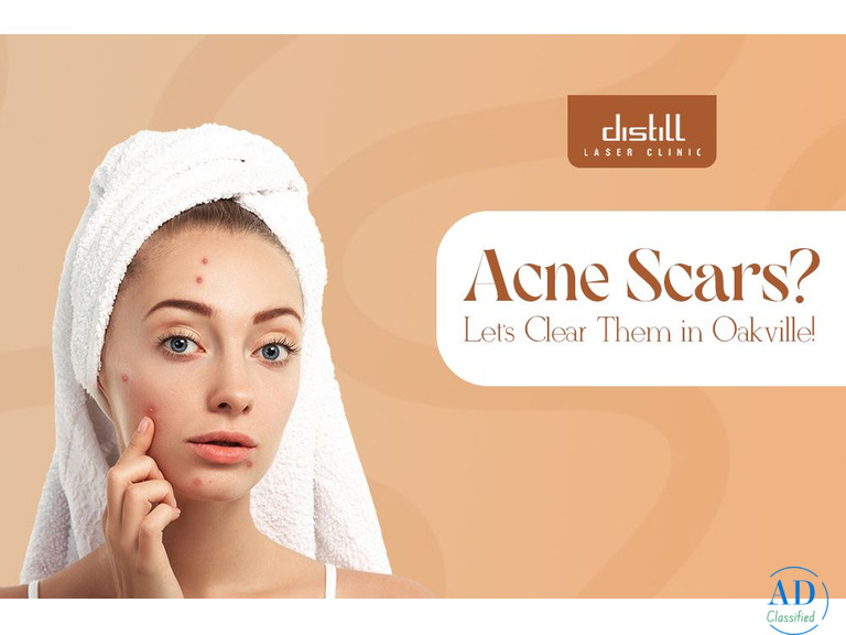 Botox Treatment For Youthful Skin In Oakville