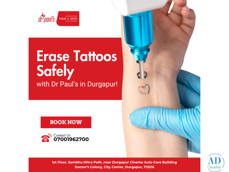 Erase Tattos safely with Dr. Pauls Durgapur