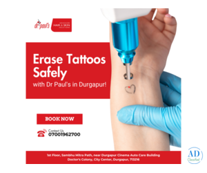 Erase Tattos safely with Dr. Pauls Durgapur