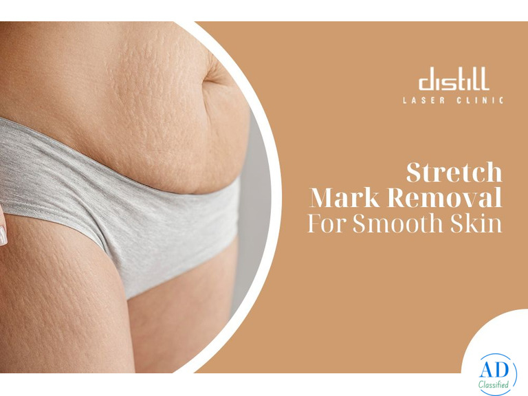 Achieve Smooth, Hair-Free Skin With Our Laser Hair Removal
