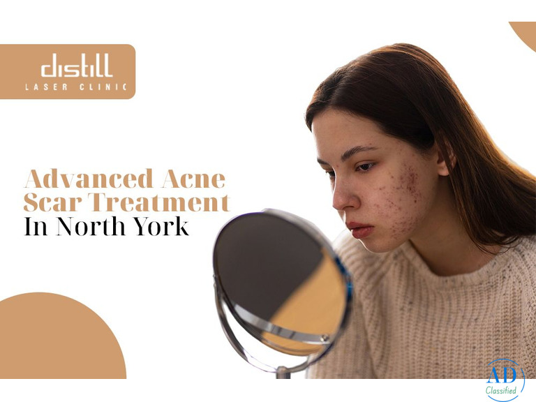 Achieve Smooth, Hair-Free Skin With Our Laser Hair Removal