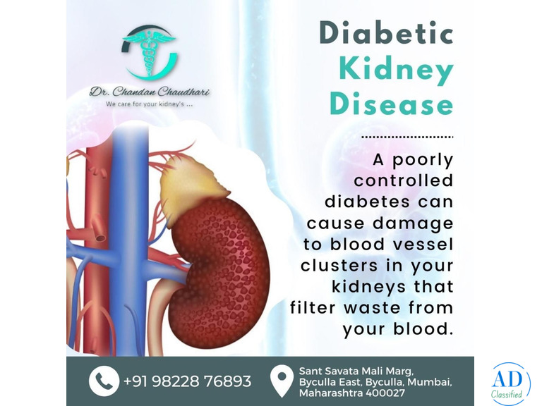 Diabetic Kidney Disease Treatment in Mumbai by Dr. Chandan Chaudhari