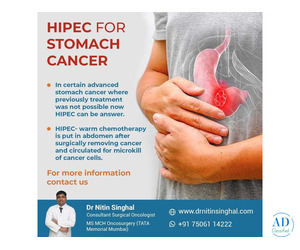 Stomach Cancer Surgeon in Ahmedabad: Accurate Surgery