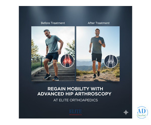 Regain Mobility with Advanced Hip Arthroscopy at Elite Orthopaedics