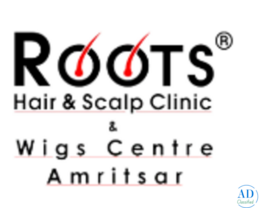 Hair Extensions in Amritsar--Roots Hair & Scalp Clinic