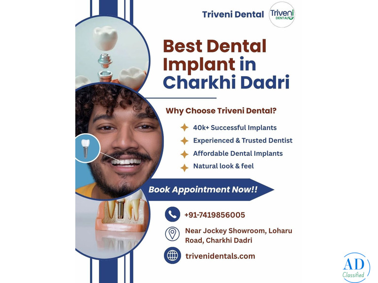 Best Dental Implant in Charkhi Dadri | Triveni Dental