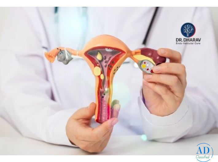Effective Uterine Fibroids Treatment by Dr. Dharav Kheradia in Mumbai, India