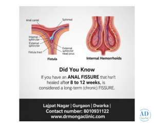 How to Heal a Fissure Fast
