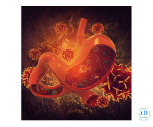 Consult Dr. Shankar Zanwar – Expert in the Best Stomach Cancer Treatment in Mumbai