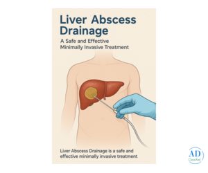 Health Education for Liver Abscess: Prevention, Treatment, and Recovery Guidance