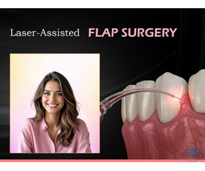 Advanced Flap Surgery Treatment in Kukatpally – FMS Dental