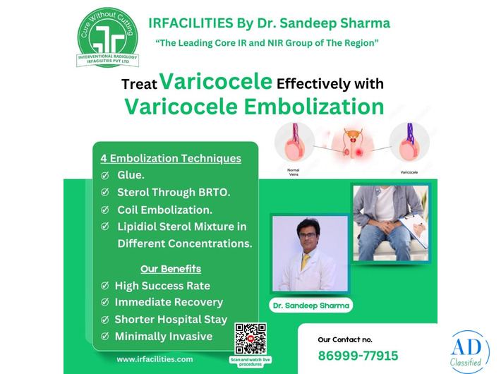 Varicocele Embolization Cost in India