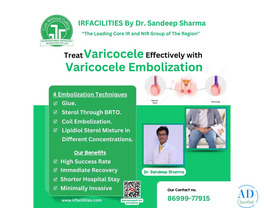 Varicocele Embolization Cost in India