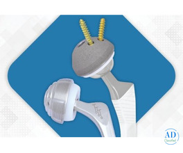 Get High-Quality Total Hip Replacement Implants with High Precision Performance by Sharma Orthopedic