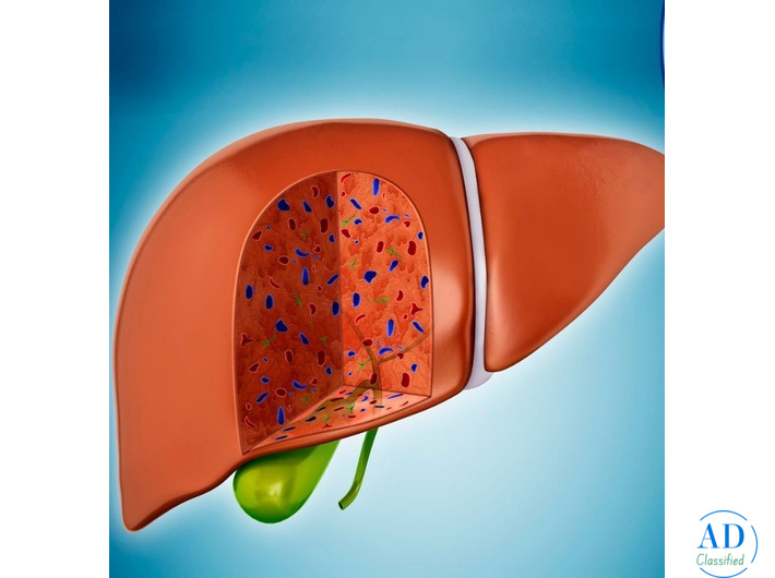 Dr. Chetan Kalal – Best Treatment for Fatty Liver in Mumbai