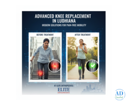 Advanced Knee Replacement Care in Ludhiana – Your Complete Guide to Pain-Free Mobility