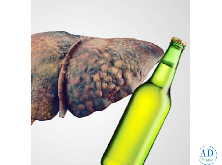 Consult Dr. Chetan Kalal for Alcoholic Liver Disease Treatment in Mumbai