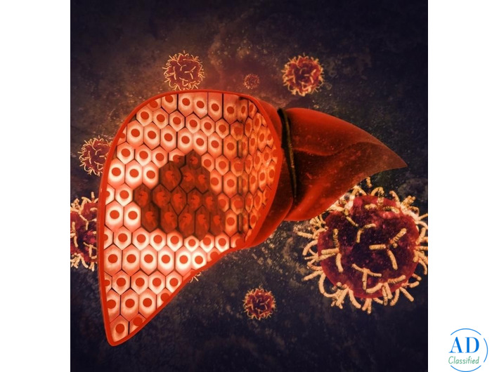 Dr. Chetan Kalal – Liver Cancer Treatment in Mumbai