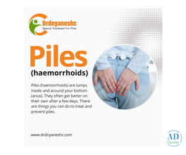 Daycare Laser Surgery for Fissure and Piles Near Me