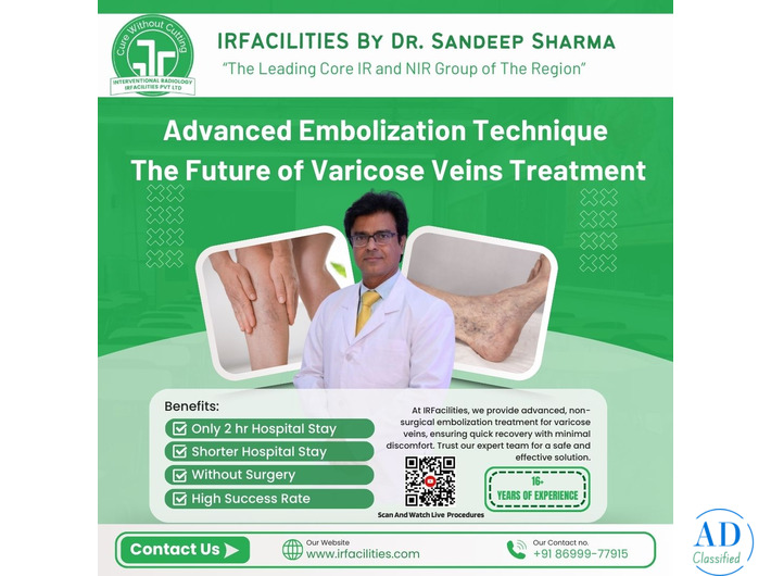 Consult the Best Varicose Vein Specialist
