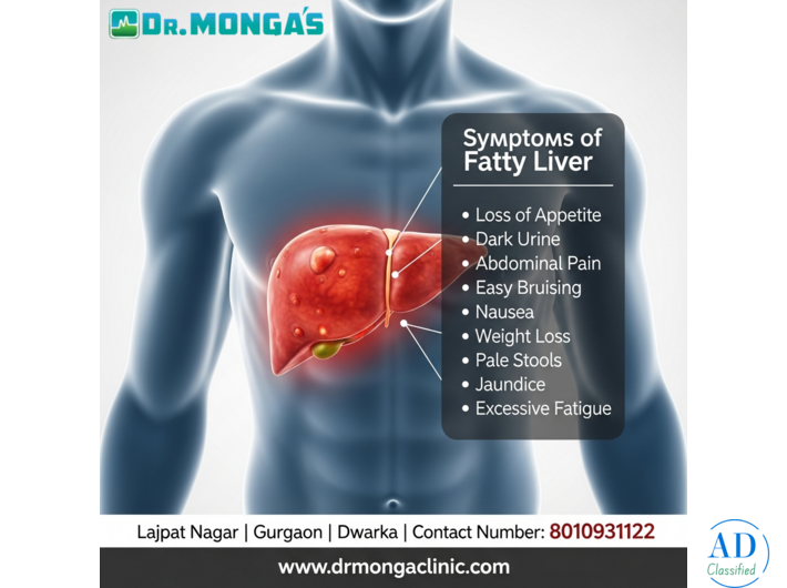 Fatty Liver Symptoms 8010931122