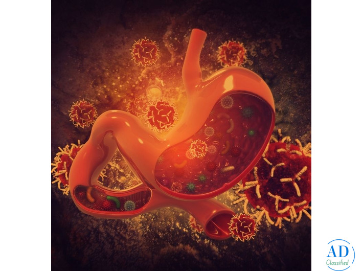 Top Doctor for Stomach Cancer Treatment in Mumbai