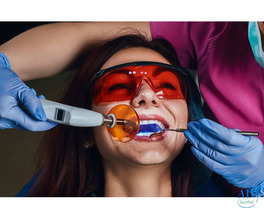 Expert Laser Dentists in Ahmedabad – Book Your Appointment