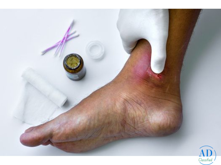 Best Surgeon for Diabetic Foot Problems in Mumbai – Dr. Dharav Kheradia