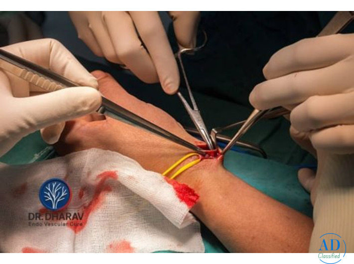 Best Dialysis Access & AV Fistula Doctor in Mumbai-Dr. Dharav Kheradia