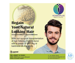 Expert Hair Transplant in Ahmedabad by Skilled Surgeons