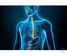 Top Esophageal Cancer Treatment in Ahmedabad | Dr. Mihir Shah