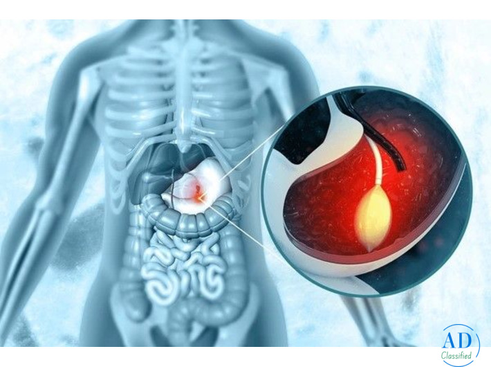 Top Doctor for Endoscopy in Mumbai