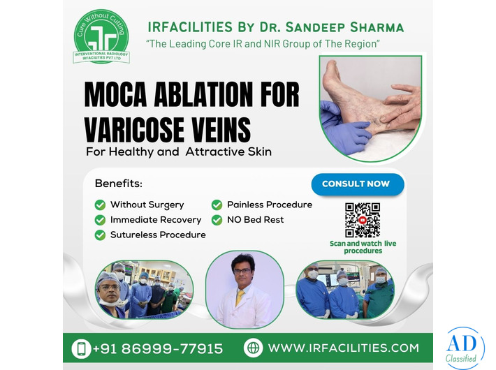Top Vein Specialist Doctor for Advanced Vein Care