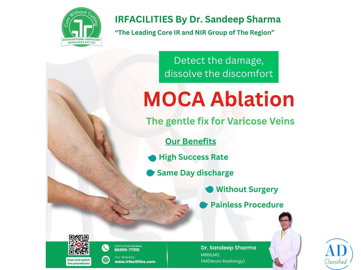 Best Varicocele Treatment Options