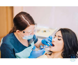 Complete Smile Makeover in Homeland, California – Call Now!