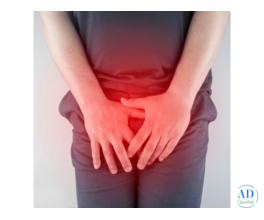 Understanding Varicocele Embolization Cost for Effective Treatment