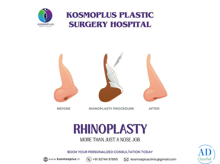 Top Clinic for Rhinoplasty in Ahmedabad with High Success Rates