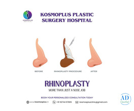 Top Clinic for Rhinoplasty in Ahmedabad with High Success Rates