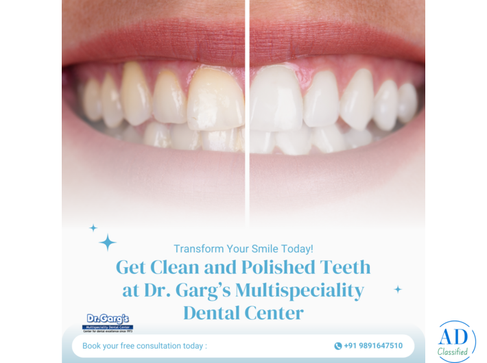 Get Clean and Polished Teeth at Dr. Garg’s Multispeciality Dental Center
