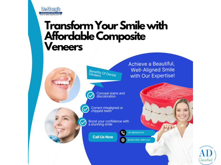 Transform Your Smile with Affordable Composite Veneers at Dr. Garg’s Multispeciality Dental Center