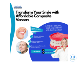 Transform Your Smile with Affordable Composite Veneers at Dr. Garg’s Multispeciality Dental Center