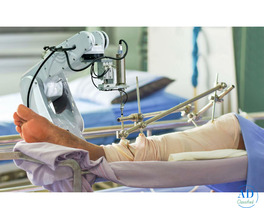 Robotic Knee Replacement Surgeon in India Provided by Saviour Hospital