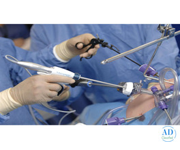 Laparoscopy Training