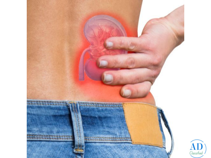 Consult Dr. Chandan Chaudhari for the Best Kidney Stone Treatment in Mumbai