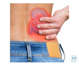 Consult Dr. Chandan Chaudhari for the Best Kidney Stone Treatment in Mumbai